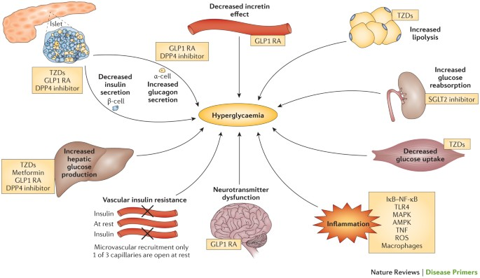 Understanding Type 2 Diabetes: Symptoms, Causes & Prevention